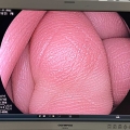 Fujinon Colonoscope Model EC-600WL Great Units